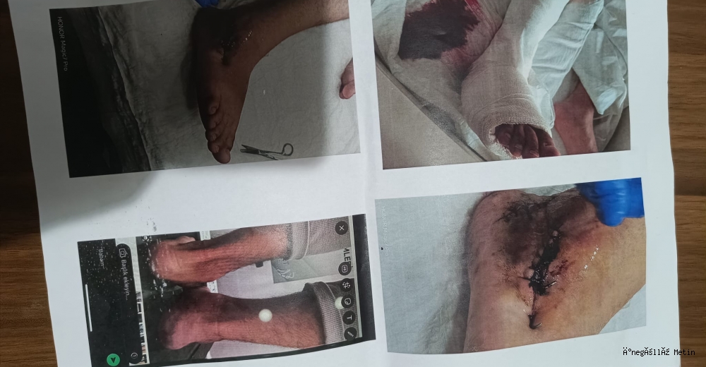 İnegöl’de sağlık dramı: “Hastanede çay içmeye bile param yok”