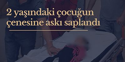 2 yaşındaki çocuğun çenesine askı saplandı