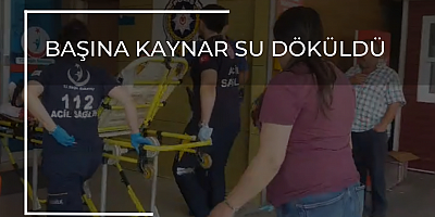 BAŞINA KAYNAR SU DÖKÜLDÜ
