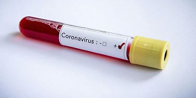 Corona virüs aşısı ile ilgili bir önemli haber de Çin’den geldi