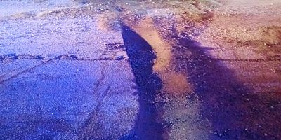 ÇUKURA GİRDİ, KAZADA YARALANDI