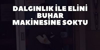 Dalgınlık ile elini buhar makinesine soktu