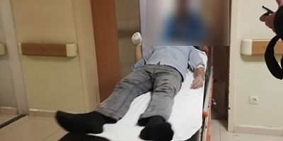 ELİNİ MAKİNEYE KAPTIRDI