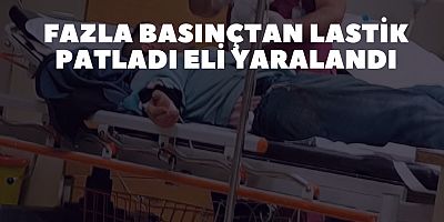 FAZLA BASINÇTAN LASTİK PATLADI ELİ YARALANDI