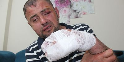 Hiç mi utanmadınız? Gaziyi, 'ayaklarını uzattın' diye öldüresiye dövdüler