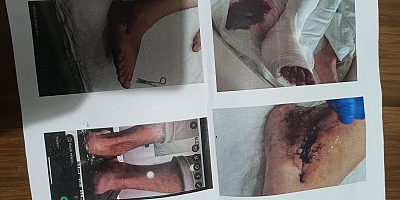 İnegöl’de sağlık dramı: “Hastanede çay içmeye bile param yok”