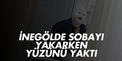 İnegölde Sobayı Yakarken Yüzünü Yaktı