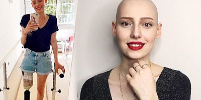 Kanserle mücadele eden Bursalı Neslican Tay'dan acı haber geldi!