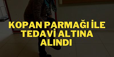 Kopan parmağı ile tedavi altına alındı 
