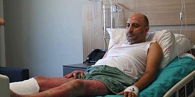 Mangal jeli nedeniyle vücudunun yüzde 38'i yanan hasta su dolu varile atlayarak kurtulmuş