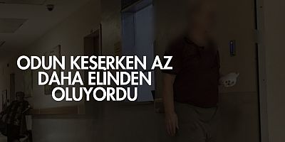 Odun keserken az daha elinden oluyordu