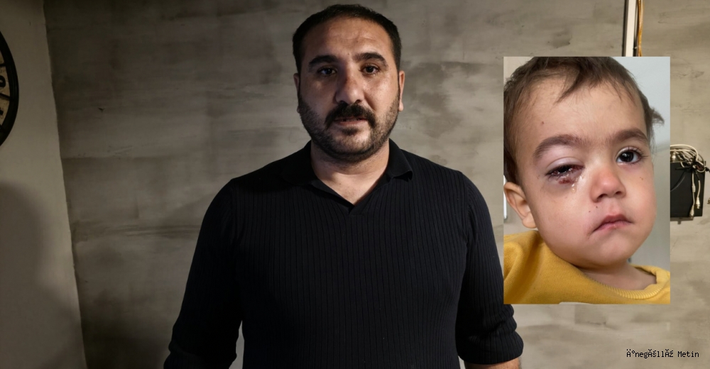 Torpil faciası: 2 yaşındaki Alpaslan sağ gözünü kaybetti